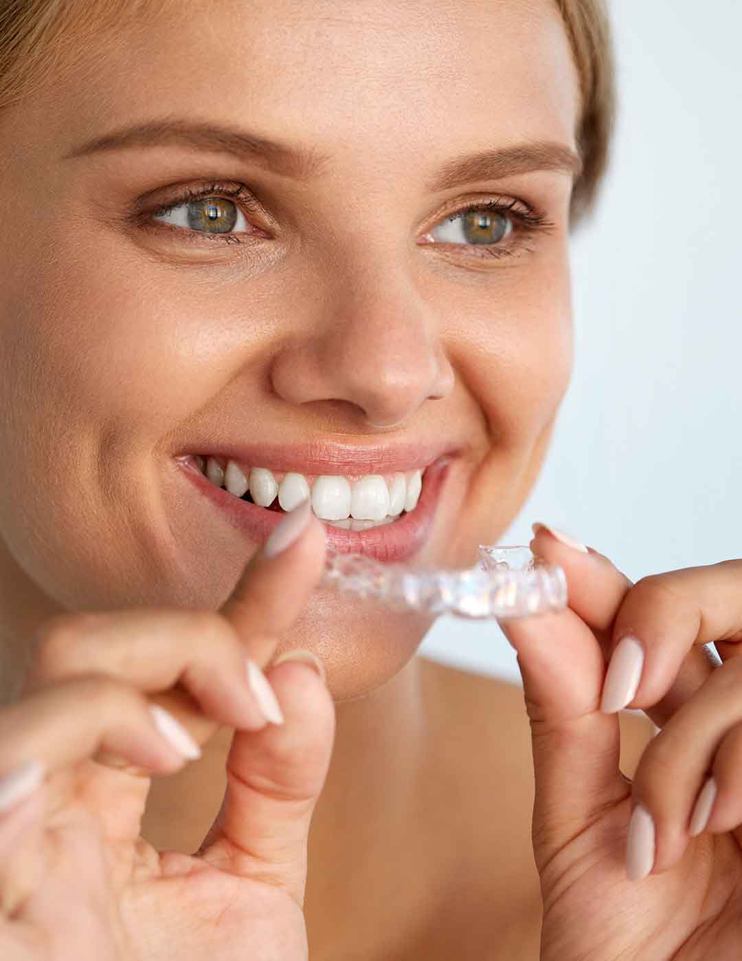 aligner-1 aligner-1