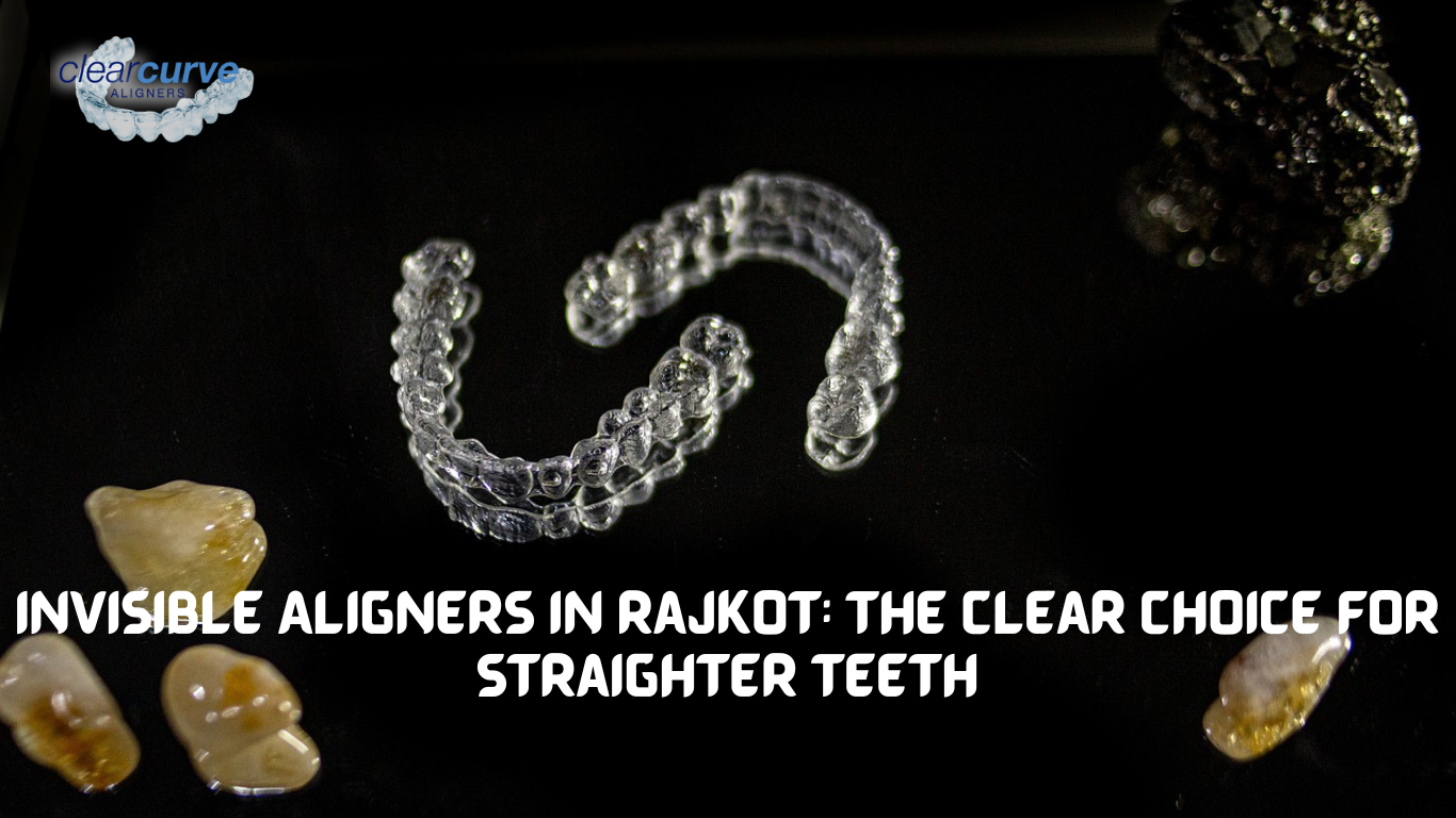 best invisible aligners in Rajkot