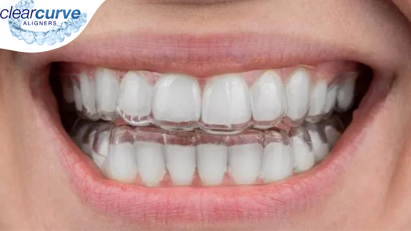 dental aligners in rajkot, gujarat