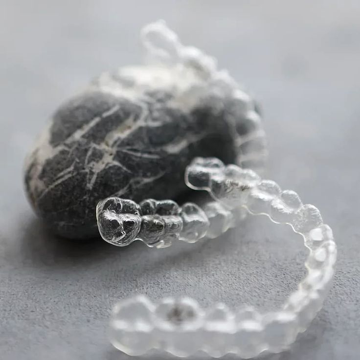 best clear aligners in rajkot, gujarat